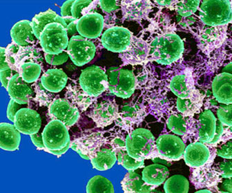 image Staphylococcus Haemolyticus